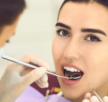 Ácido hialurónico una de las soluciones a la sonrisa gingival